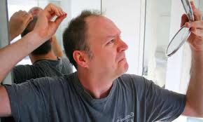 It also affects about 55 percent of females over the age of 80. Seven Ways To Avoid Hair Loss Men S Hair The Guardian