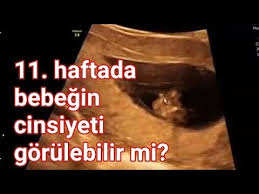 Bebek ve ebeveyn arasındaki duygusal bağın güçlenmesine ve gebeliğin 20. 11 Haftada Bebek Cinsiyeti Gorulur Mu Youtube