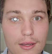 Diamond Artificial Eye Prosthetic by John Imm Prosthetics 😳 #oddxfashion