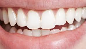 Cosmetic Dentistry Trends 2024 | Innovations at Chrysanth