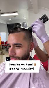 Cole Anthony Hair Balding