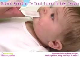 3 best ways to clean your baby tongue: Thrush In Babies 11 Effective Home Remedies Parenting Healthy Babies