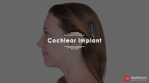 We did not find results for: Cochlear Implant Surgery Costs Top Doctors Procedures And Hospitals