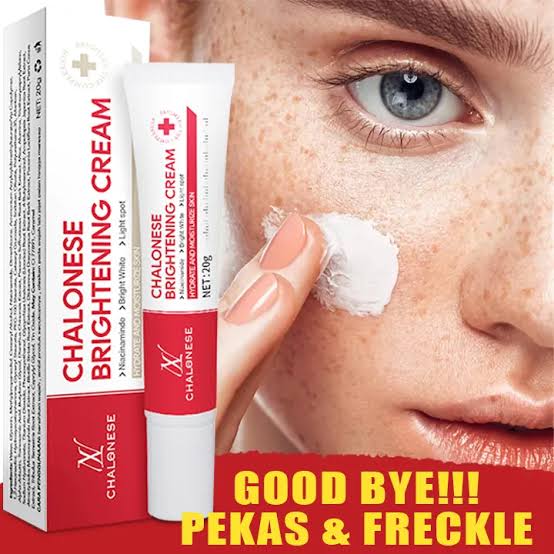 Chalonese Whitening Freckle Cream Remove Dark Spots Anti Freckle Cream
