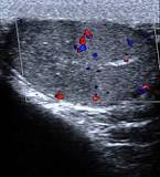 Image result for icd 10 code for left side testicular pain