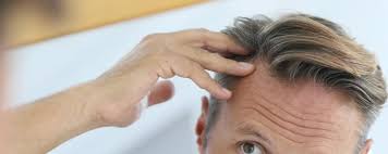 Mechanisms and management of alopecia and graying. Best Hair Loss Treatment For Men Hair Regrowth Hair Fall Solution Cyber Hairsure