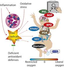 Image result for Delayed Transition from Fetal Circulation