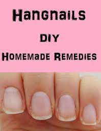 Home Remedies For Hangnails Hangnail Nail Remedies Beauty Hacks Nails