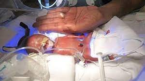 Blood Boosters May Give Tiny Preemies A Developmental Edge