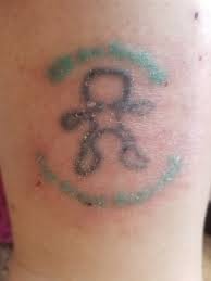 For your convenience, many offices may have payment plans and installment options that they can discuss with you. Will Insurance Cover Removal Of A Tattoo That I Am Allergic To Photo