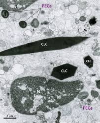 Red Blood Cells Under The Microscope, Hypo And Hypertonic Solutions -  Youtube