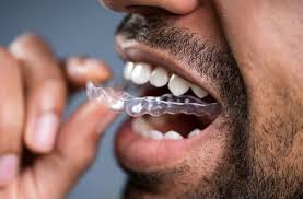 We did not find results for: Should You Use A Dental Mouthguard For Your Jaw Pain Health Essentials From Cleveland Clinic