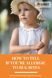 Bug Bites That Look Like Mosquito Bites But Aren T Nobody Likes Getting Stung By Bees Or Bitten By Mosquitos But For Those Allergic The Experie Allergic To Bug Bites Kids Allergies Allergic To Mosquito Bites