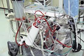 Where the fabric is passed over some free roller & guider. Cardiac Perfusionist Expertise Specialties And Training