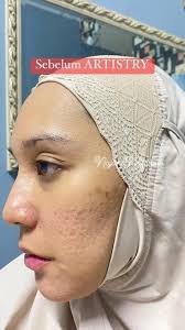 Nnti kita share ya diamond