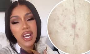 Cardi b dragon ball z memes. Cardi B Asks Twitter For Help With Blackheads On Her Cheek And Chin S Is Uncomfortable Daily Mail Online