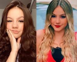 Check spelling or type a new query. Voce Sabe O Que Fernanda Souza E Bela Fernandes Tem Em Comum As Duas Atrizes Fizeram Rinoplastia Ainda Na Adolescencia A Rinoplastia E Uma Das Cirurgias Mais Procuradas Entre Os Jovens Entenda