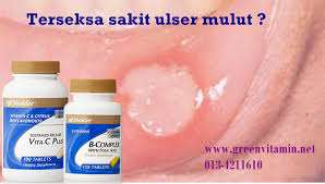 Ulser di mulut ini kebiasaannya muncul kerana badan kekurangan vitamin b12, vitamin c atau juga kekurangan zat besi selain dehidrasi kerana tidak meminum air secukupnya. Panduan Dan Tips Kesihatan Vitamin Semulajadi
