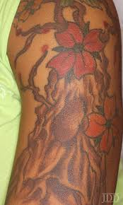 While tattoos are generally considered permanent, it is now possible to remove them with treatments, fully or partially. Eruptive Milia Within A Tattoo Next Steps In Dermatology