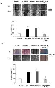 28m likes · 92,812 talking about this · 610 were here. Ijms Free Full Text Inhibition Of Aqp1 Hampers Osteosarcoma And Hepatocellular Carcinoma Progression Mediated By Bone Marrow Derived Mesenchymal Stem Cells Html