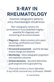 Image result for XRay Changes in Rheumatic Conditions