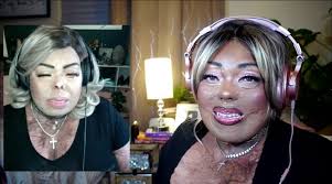 I asked to ChatGPT to make a thumbnail… I don't know what else to say.😂  This makes me giggle, but it's an example of how AI does not understand  facial difference and