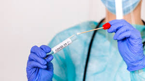 An antibody test is also known as serology (blood) test. Covid 19 Test That Relies On Viral Genetic Material Gives False Negative Results If Used Too Early In Those Infected
