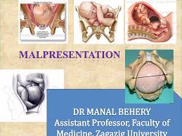 Image result for Compound Presentation