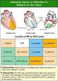 Electrocardiogram Interpretation Skills Made Simple