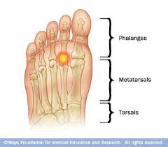 Pin On Fitness Injuries