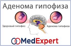 Диагностические мероприятия