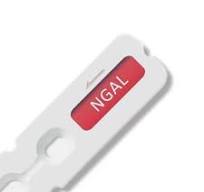 NGAL test kit - 00020C - Beijing O&D Biotech Co., Ltd ...