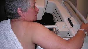 More women getting both breasts removed when cancer strikes one