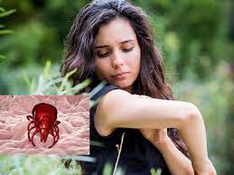 Actuellement le diagnostic se fait par un test appelé. Maladie De Lyme Pourquoi Les Tests Ne Sont Pas Fiables Sciences Et Avenir