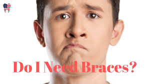 They are clear and will not stain during the treatment process. Do I Need Braces Take The Quiz Youtube