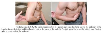 Image result for Lift-Off Subscapularis Test