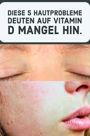 Die auswirkungen von vitamin d mangel können vielfältig sein und verschieden starke formen annehmen. Diese 5 Hautprobleme Deuten Auf Vitamin D Mangel Hin Vitamin D Movie Posters Vitamins