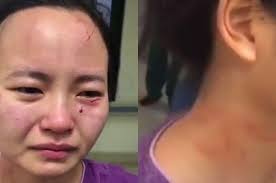 Tatalaksana dari perlindungan terhadap kekerasan fisik pada pasien sebagai 2. Pertaruhkan Jiwa Dan Raga Rawat Pasien Virus Corona Perawat Ini Malah Alami Kekerasan Dari Pasien Hingga Luka Parah Di Sekujur Tubuh Kondisinya Bikin Nangis Semua Halaman Pop Grid Id