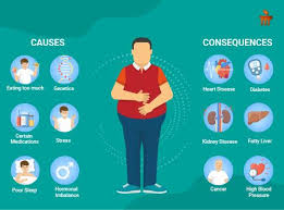 Image result for Obesity