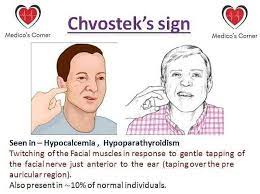 House looks for the chvostek sign in a patient, who holds him and thirteen as hostages because he. Facebook