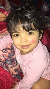 This post shows photos for medical and educational￼ purposes) I'm proud to  show off these photos, which represent a pivotal moment in my reproductive  journey. After having my ovarian tubes removed in