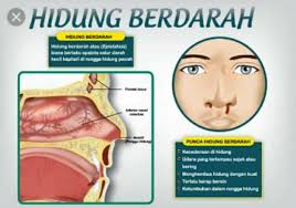 Ada banyak tanda tanda ataupun simtom kanser yang perlu anda ketahui. Kanser Pangkal Hidung Cream Ajaib Bio Ever Plus Facebook