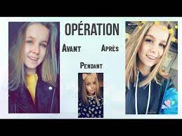 Se faire enlever un tatouage laser ou chirurgie. Operation J Ai Retire Mon Grain De Beaute Youtube