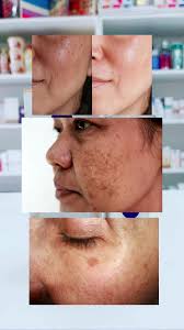 Elimina y previene manchas con Serum de Nivea