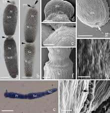 Image result for Lankesteria