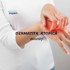 Dermatita Atopică Boli Autoimune Health Tips Medical Health