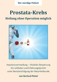 Prostata Krebs Heilung Ohne Operation Moglich Ein Erfahrungsbericht Und Leitfaden Unter Berucksichtigung Der Naturheilkunde Pelzel Gerhard Amazon De Bucher