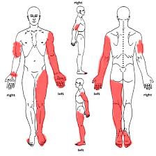 Pin On Crps