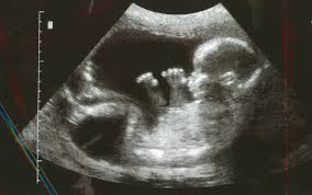 Ultrasound Trish Nugent Writer
