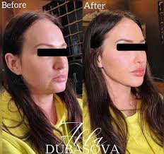 Liz Shockley (discountliz)